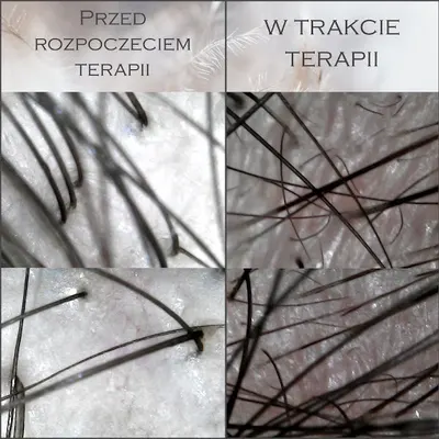 Trycholog Anna Szczepaniak - Sakura Instytut Piękna